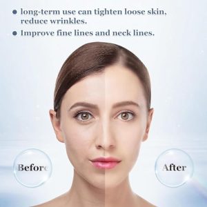 Portable Skin Tightening Beauty Toning Device